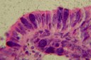 Coccidia in intestinal mucosa