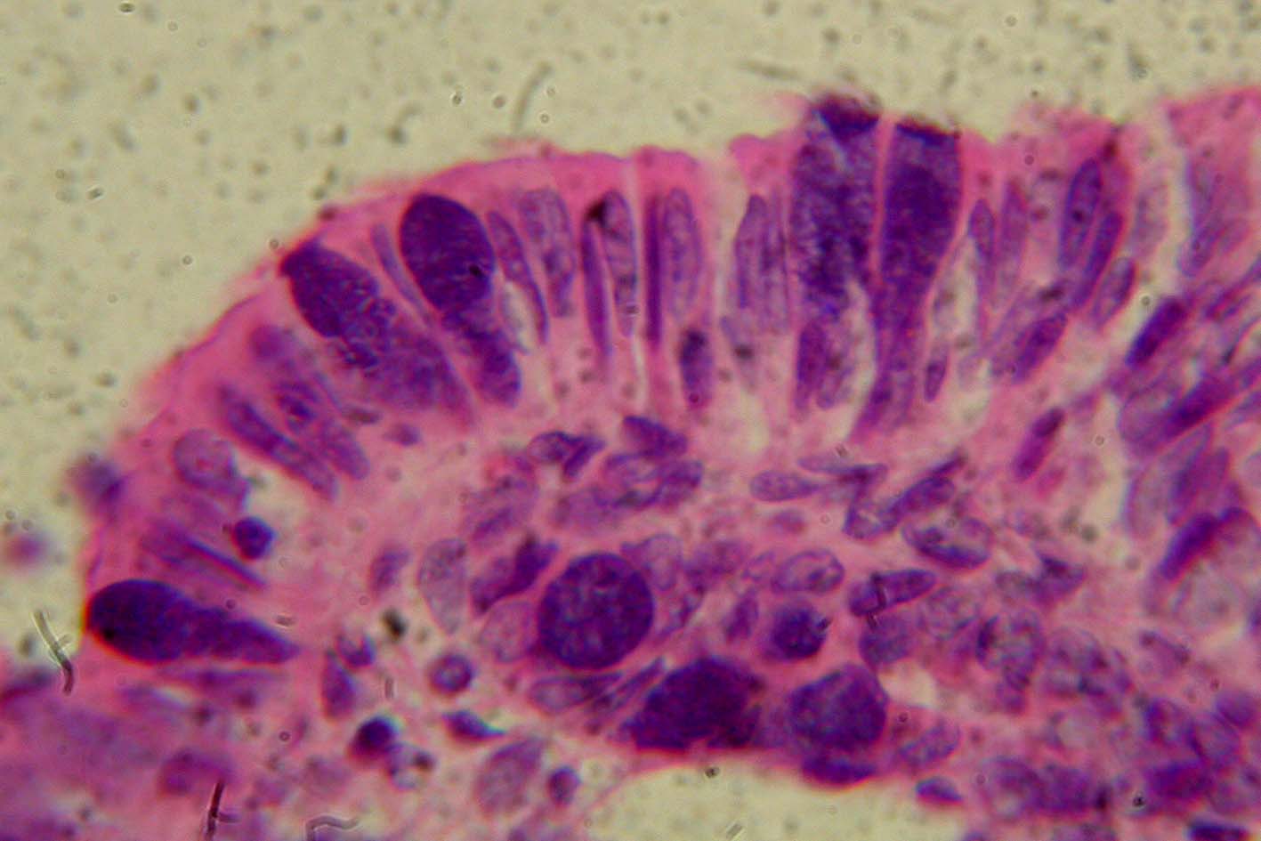 Coccidia in intestinal mucosa