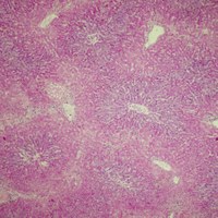 In this view, several complete lobules can be seen and there is marked acute hepatocellular necrosis (pinker colour) with only the hepatocytes (bluer colour) close to the central vein (whitish 'hole') being spared. This picture is typical of RHD. RHDV2 was confirmed by PCR testing in this case.